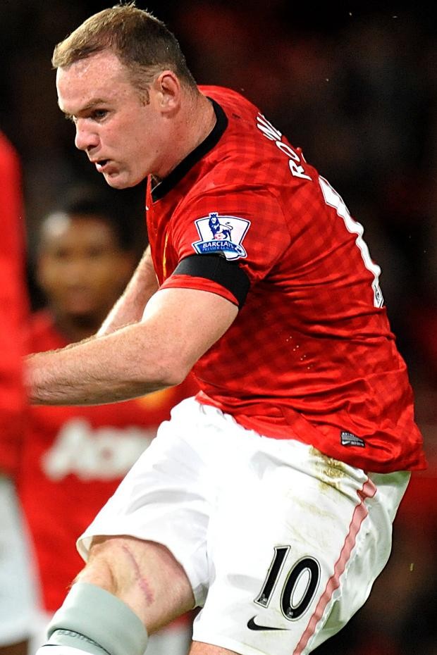 Cận cảnh vết rách trên đùi của Rooney đã lành lặn...